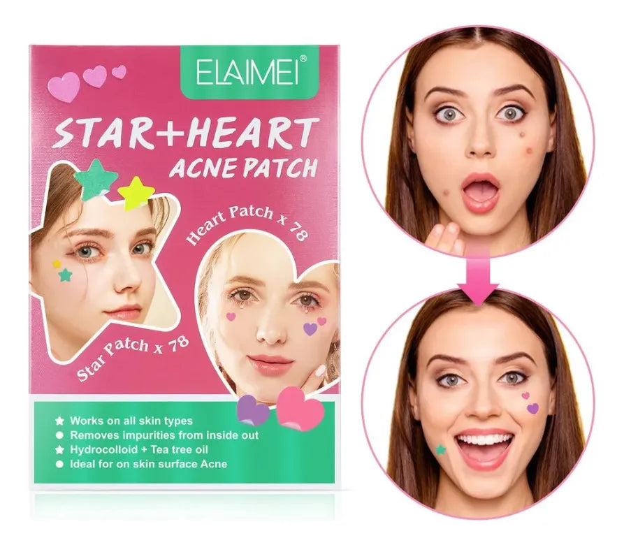 Kit de Emergencia: Parches para Acné Star+Heart (156 uds) - Lleva 2 Cajas x $89.900
